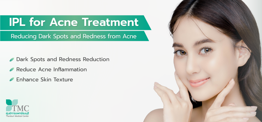 IPL Treatment for Acne: Reducing Dark Spots and Redness from Acne