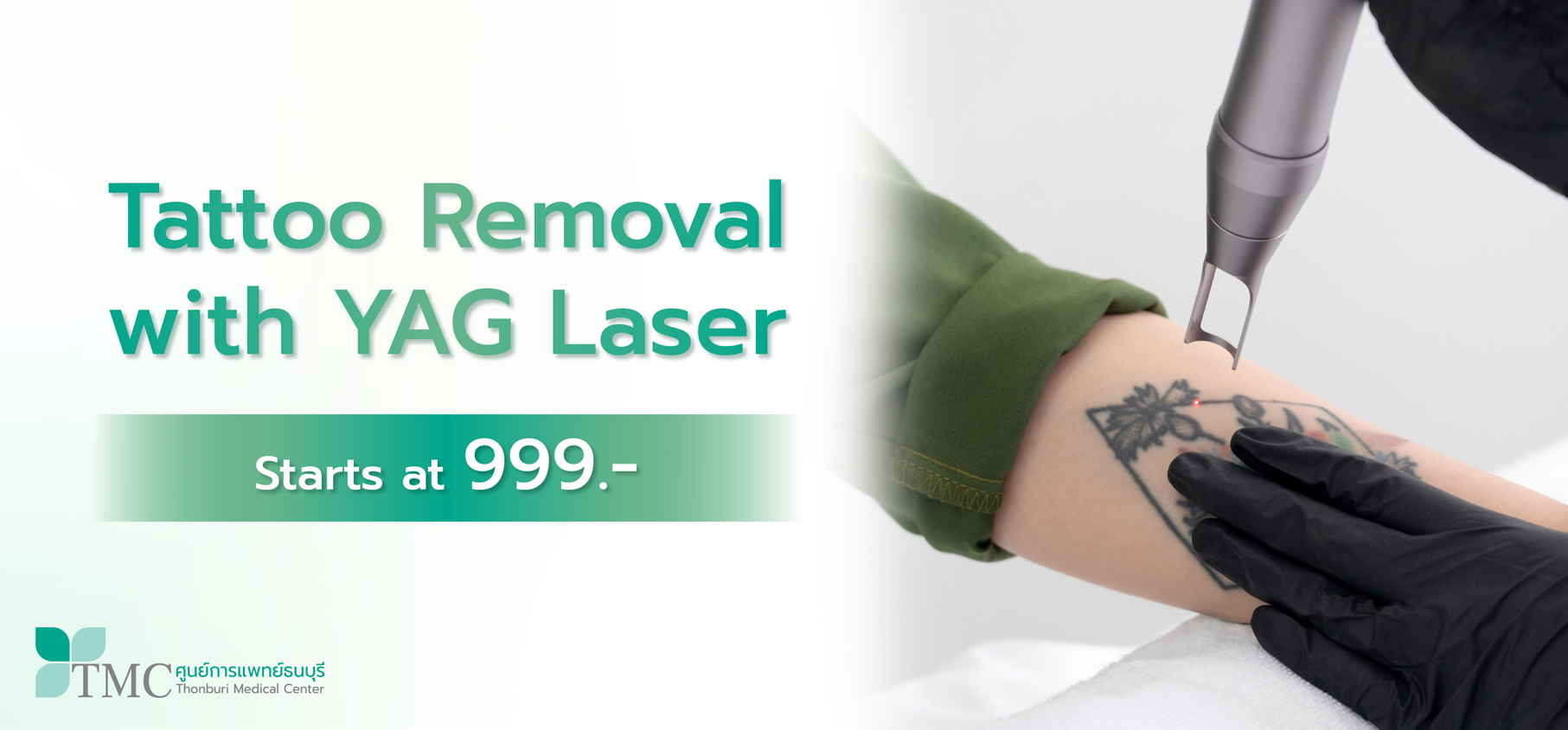 Tattoo Removal with YAG Laser