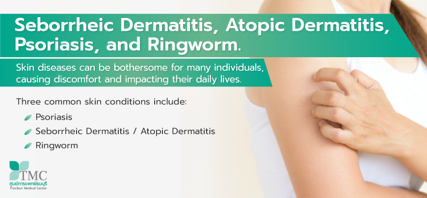 Treatment of skin diseases, Seborrheic Dermatitis, Atopic Dermatitis , Psoriasis, and Ringworm.