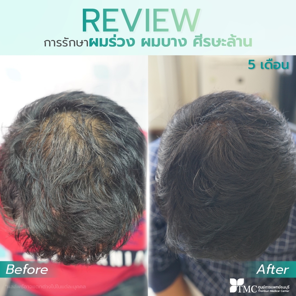 Hair Growth Review
