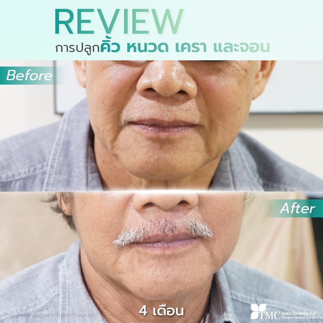 Face and Body Hair Growth Review