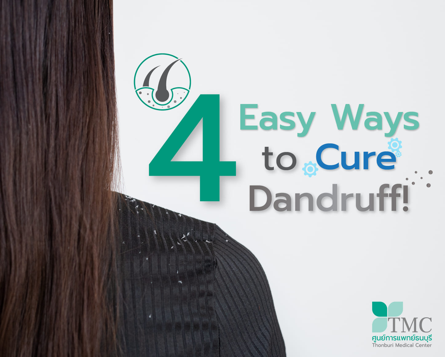 4 Easy Ways to Cure Dandruff!