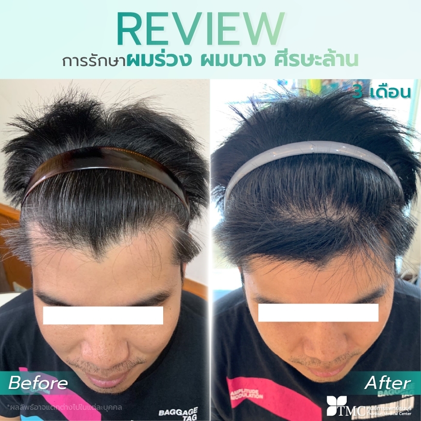 Hair Growth Review